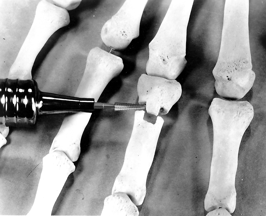 Jordan Day Surgical Mill in use